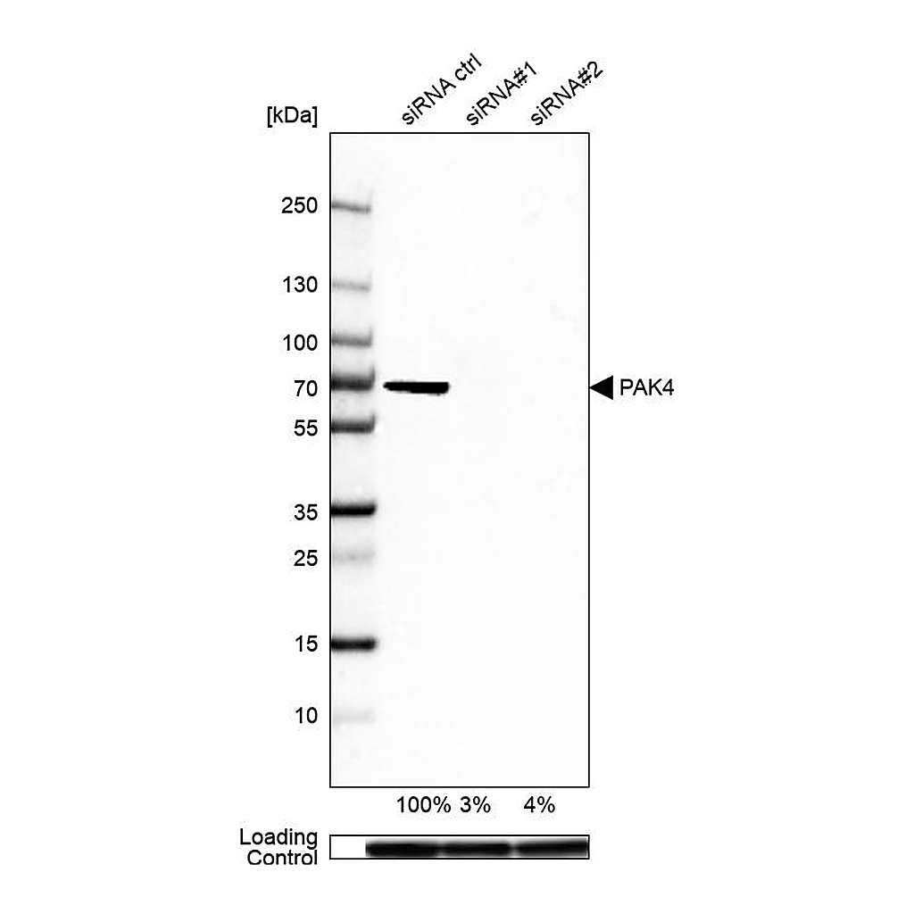 Atlas Antibodies Anti-PAK4 Antibody