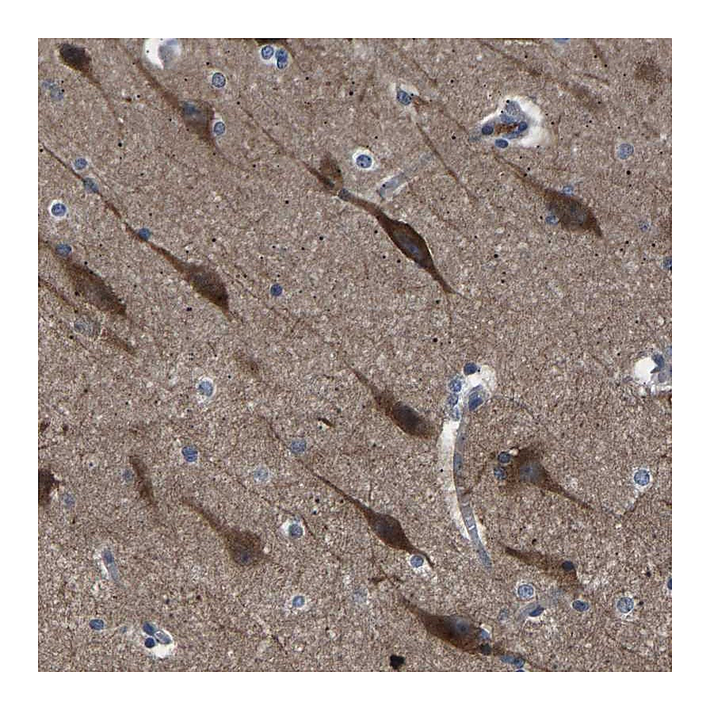 Atlas Antibodies Anti-PAK5 Antibody