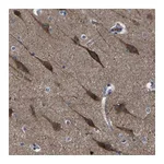 Atlas Antibodies Anti-PAK5 Antibody