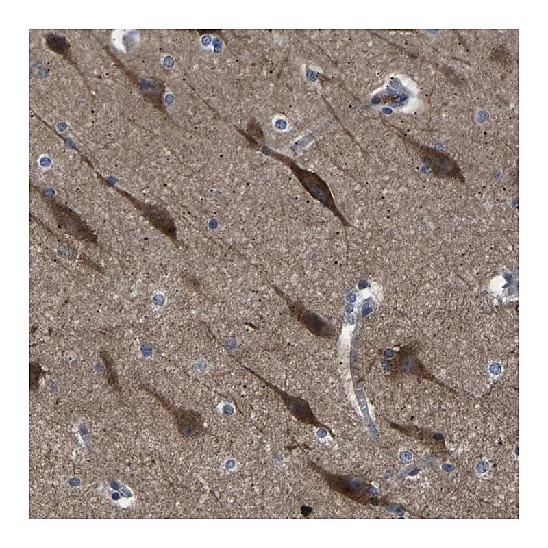 Atlas Antibodies Anti-PAK5 Antibody