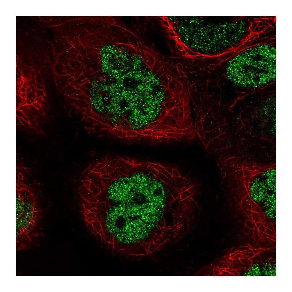 Atlas Antibodies Anti-PALB2 Antibody