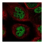 Atlas Antibodies Anti-PALB2 Antibody