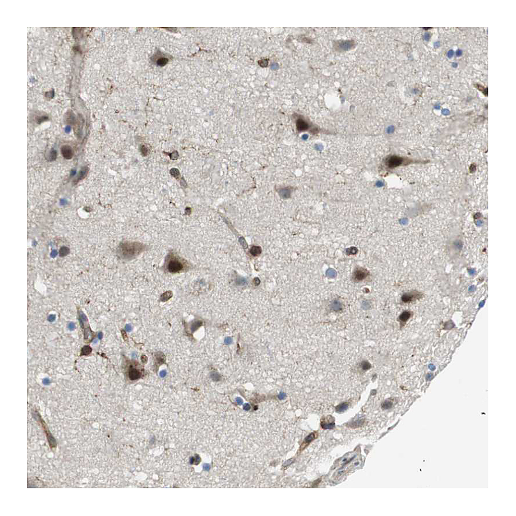 Atlas Antibodies Anti-PALD1 Antibody