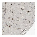 Atlas Antibodies Anti-PALD1 Antibody