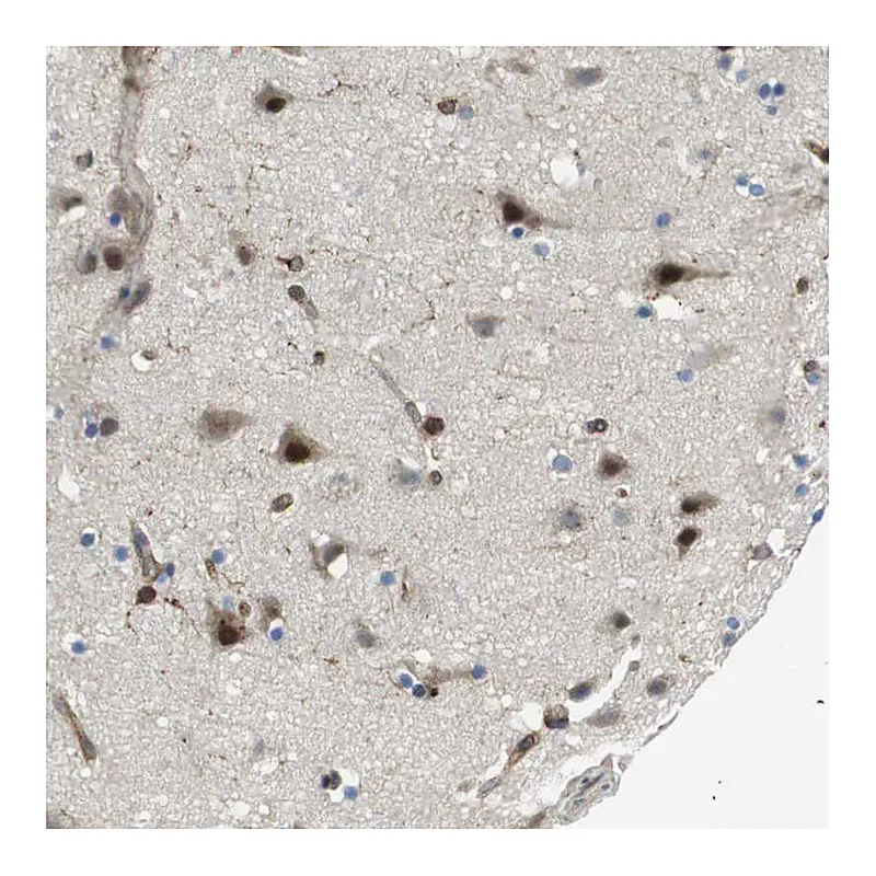Atlas Antibodies Anti-PALD1 Antibody