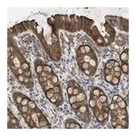 Atlas Antibodies Anti-PALD1 Antibody