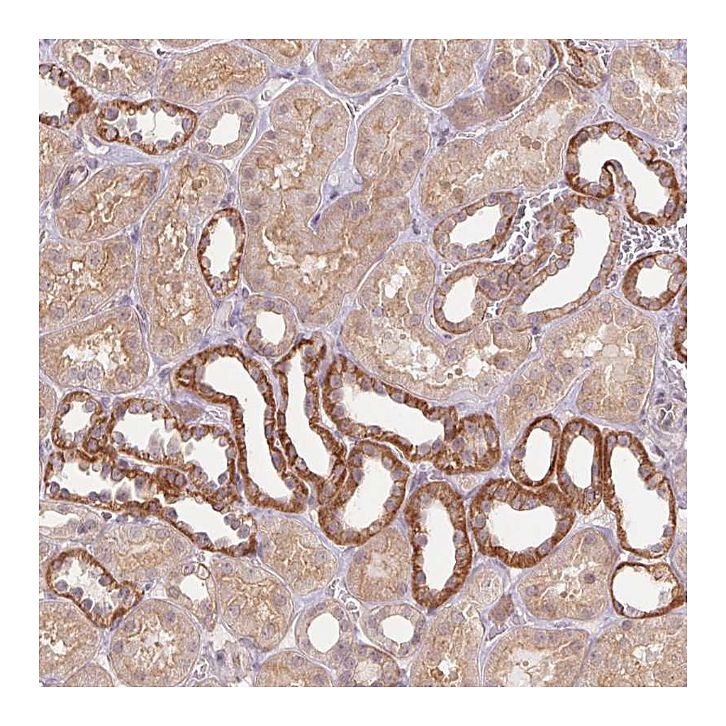 Atlas Antibodies Anti-PALM Antibody