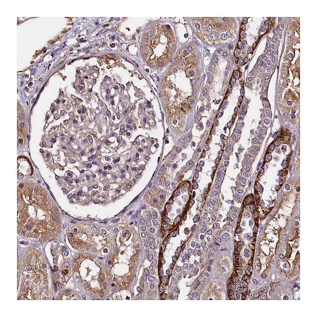 Atlas Antibodies Anti-PALM Antibody