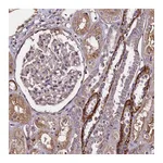 Atlas Antibodies Anti-PALM Antibody
