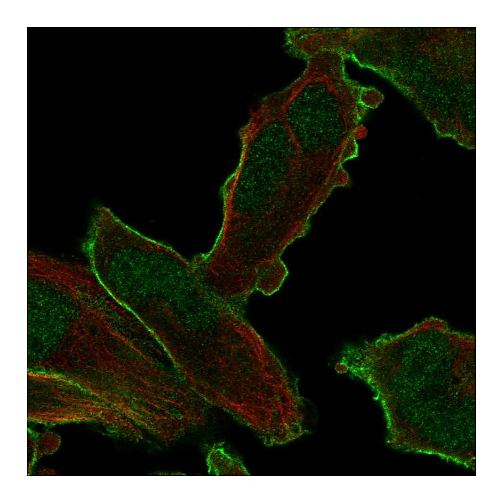 Atlas Antibodies Anti-PALM2 Antibody
