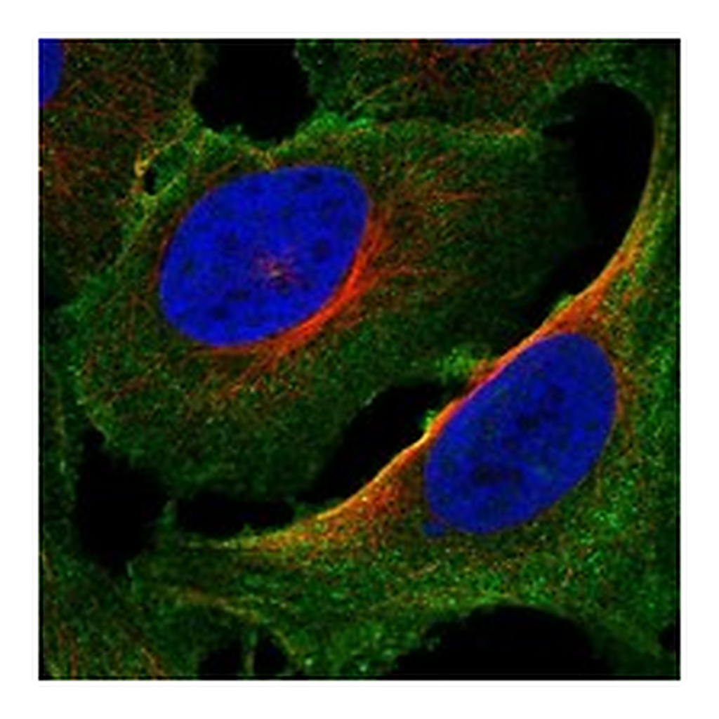Atlas Antibodies Anti-PALM2AKAP2 Antibody