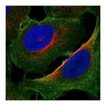 Atlas Antibodies Anti-PALM2AKAP2 Antibody