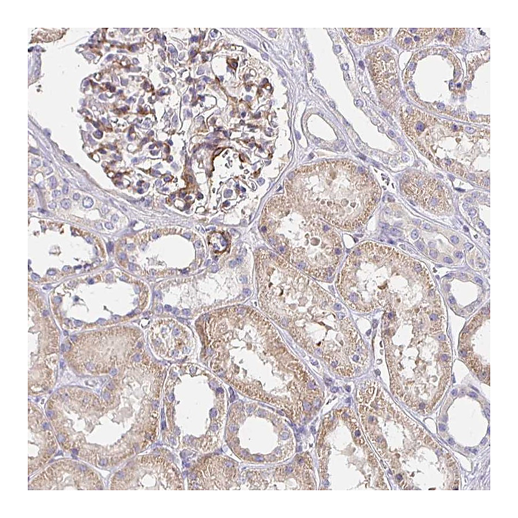 Atlas Antibodies Anti-PALM2-AKAP2 Antibody