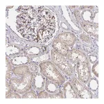 Atlas Antibodies Anti-PALM2-AKAP2 Antibody