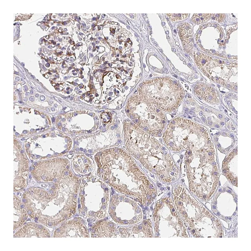 Atlas Antibodies Anti-PALM2-AKAP2 Antibody