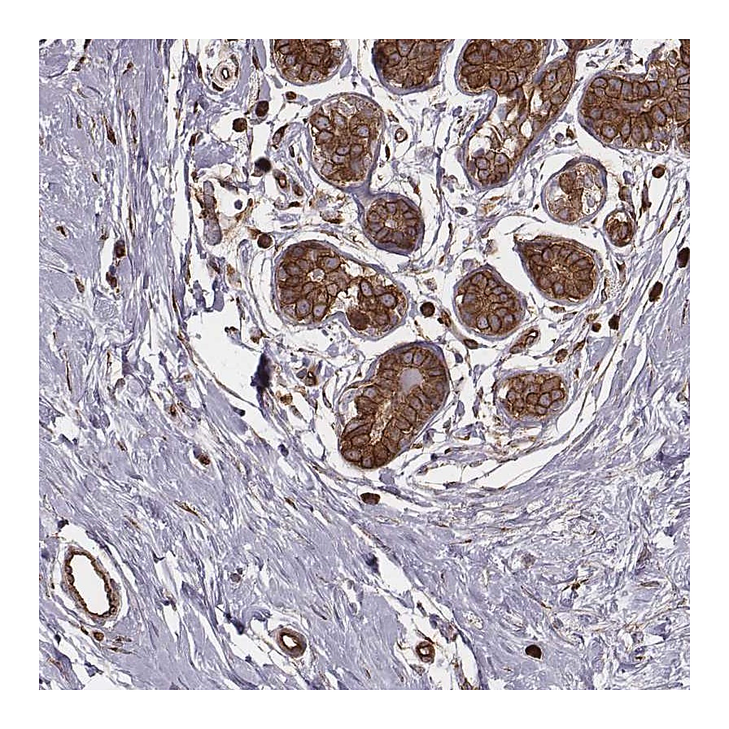 Atlas Antibodies Anti-PALMD Antibody