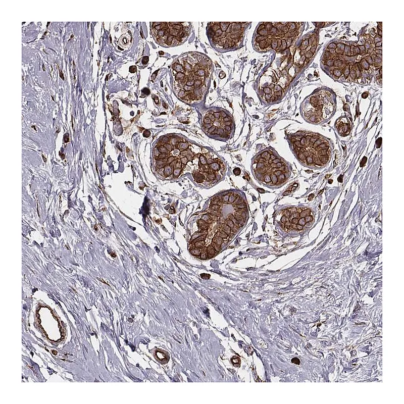 Atlas Antibodies Anti-PALMD Antibody
