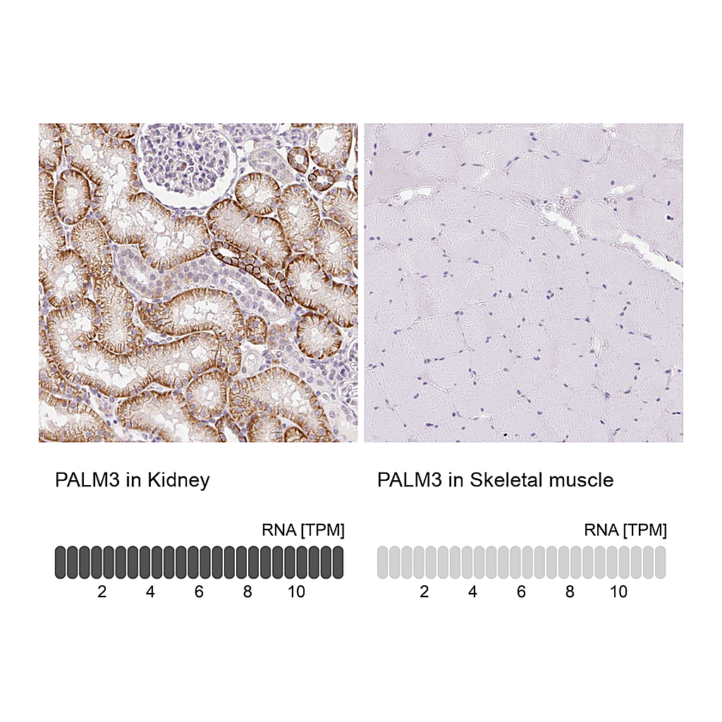 Atlas Antibodies Anti-PALM3 Antibody