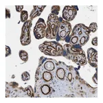Atlas Antibodies Anti-PALMD Antibody