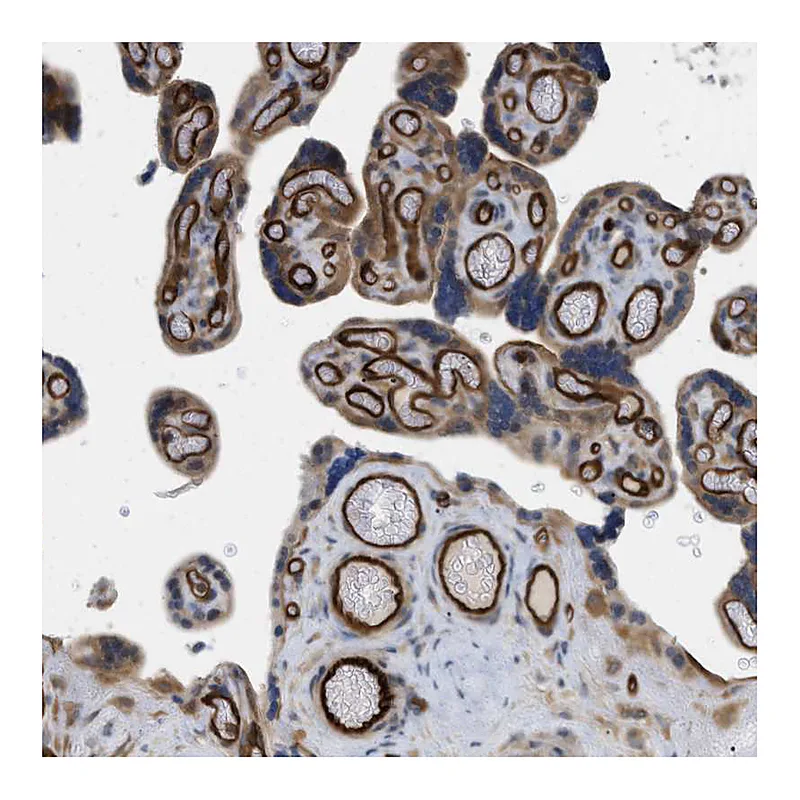 Atlas Antibodies Anti-PALMD Antibody