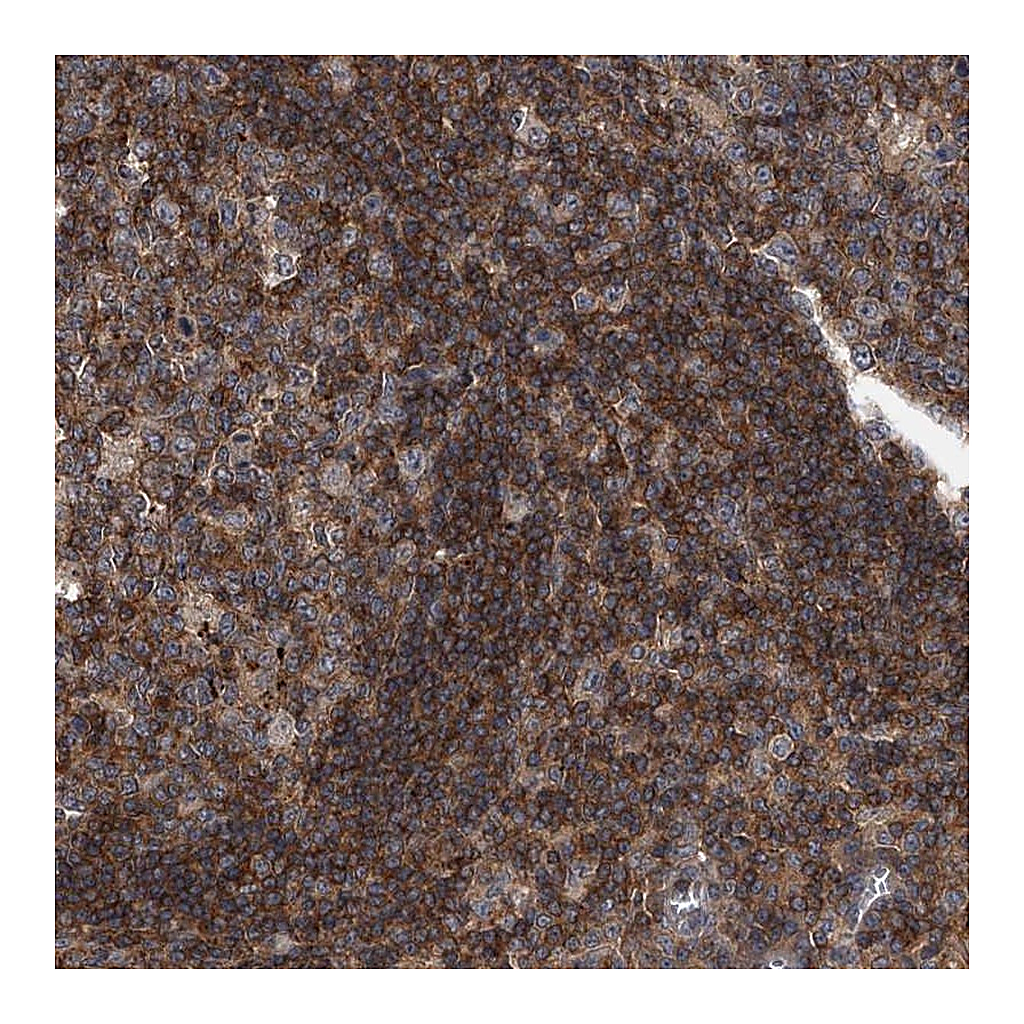 Atlas Antibodies Anti-PAN3 Antibody
