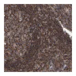 Atlas Antibodies Anti-PAN3 Antibody