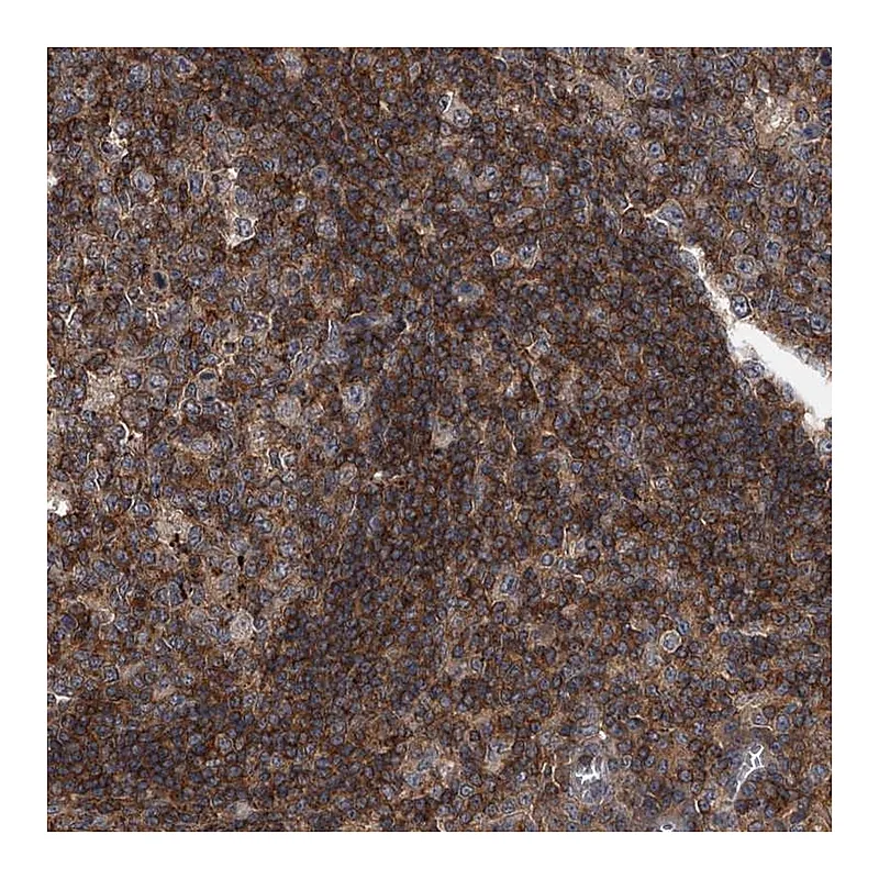 Atlas Antibodies Anti-PAN3 Antibody
