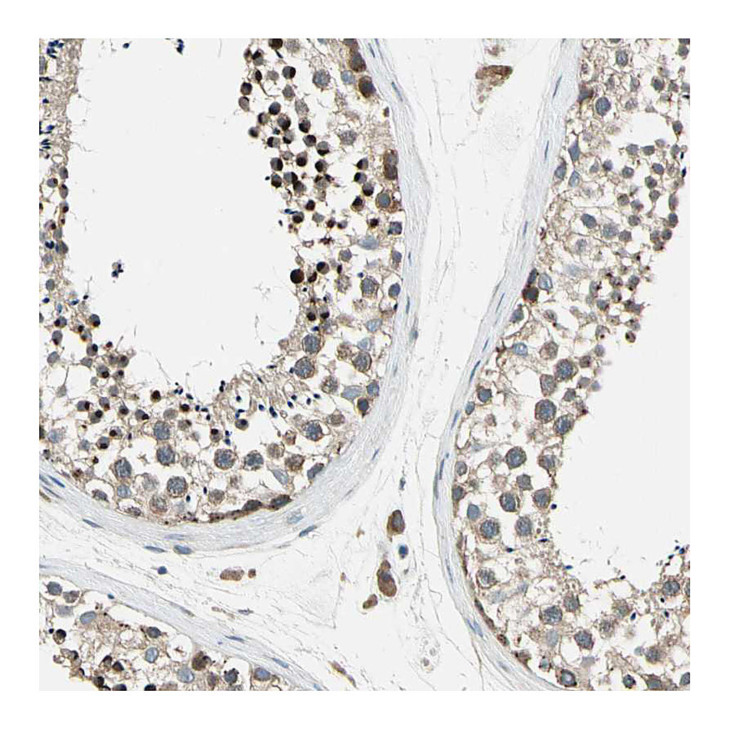Atlas Antibodies Anti-PANK2 Antibody