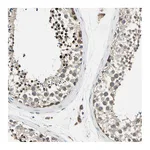 Atlas Antibodies Anti-PANK2 Antibody