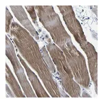 Atlas Antibodies Anti-PANK4 Antibody