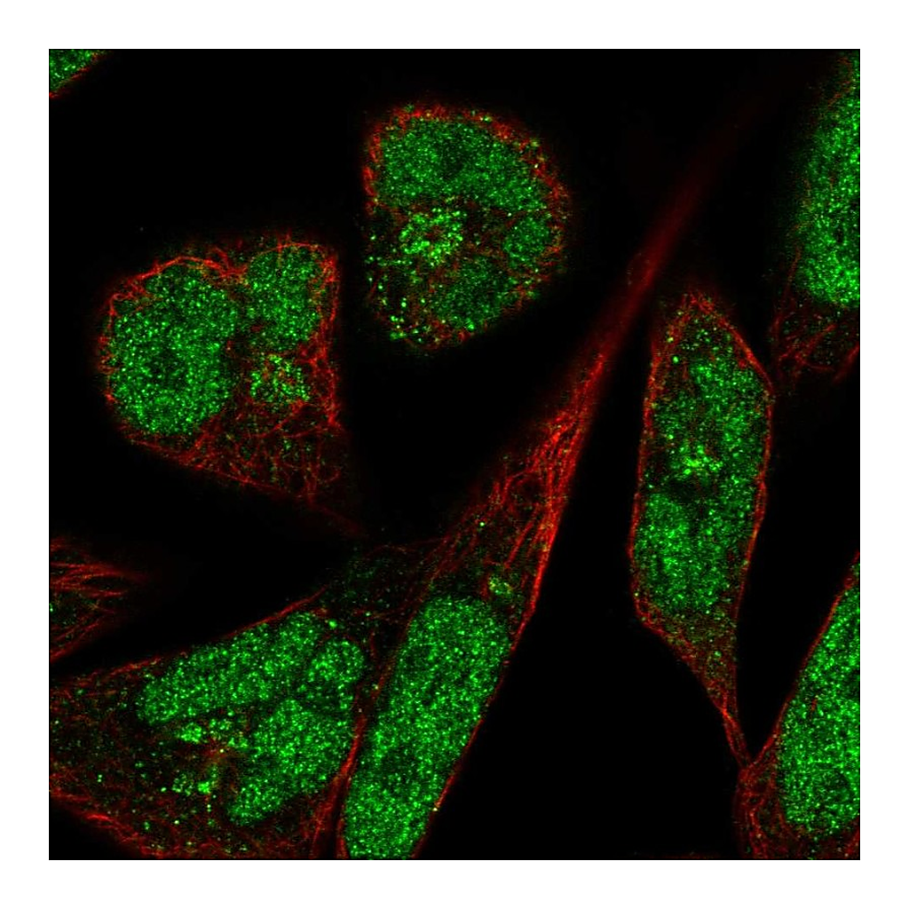 Atlas Antibodies Anti-PANK3 Antibody