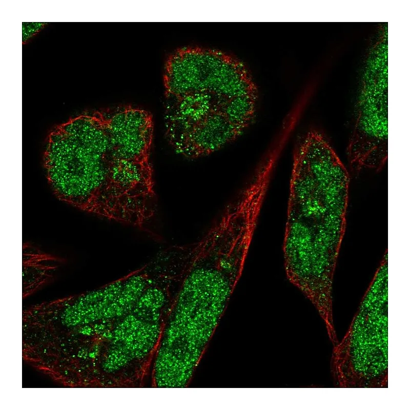 Atlas Antibodies Anti-PANK3 Antibody