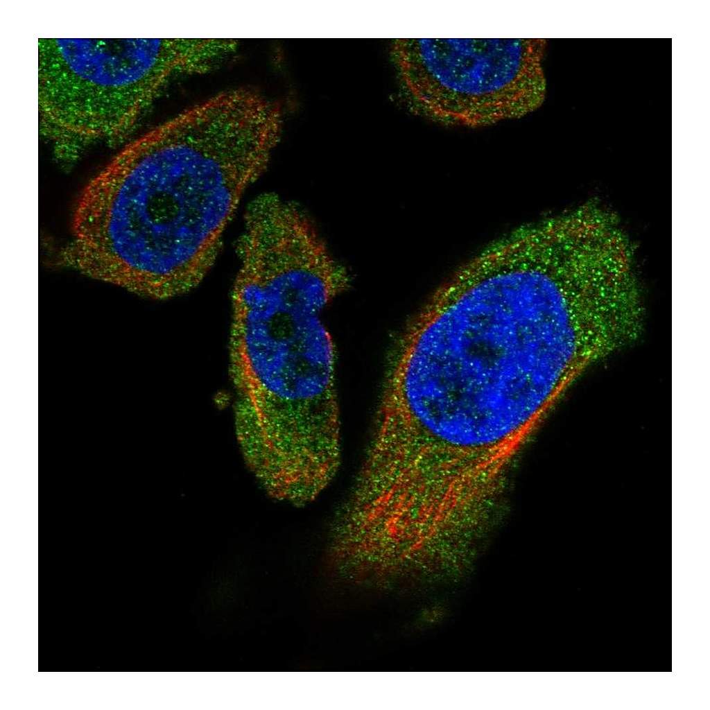 Atlas Antibodies Anti-PANK4 Antibody
