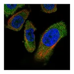 Atlas Antibodies Anti-PANK4 Antibody