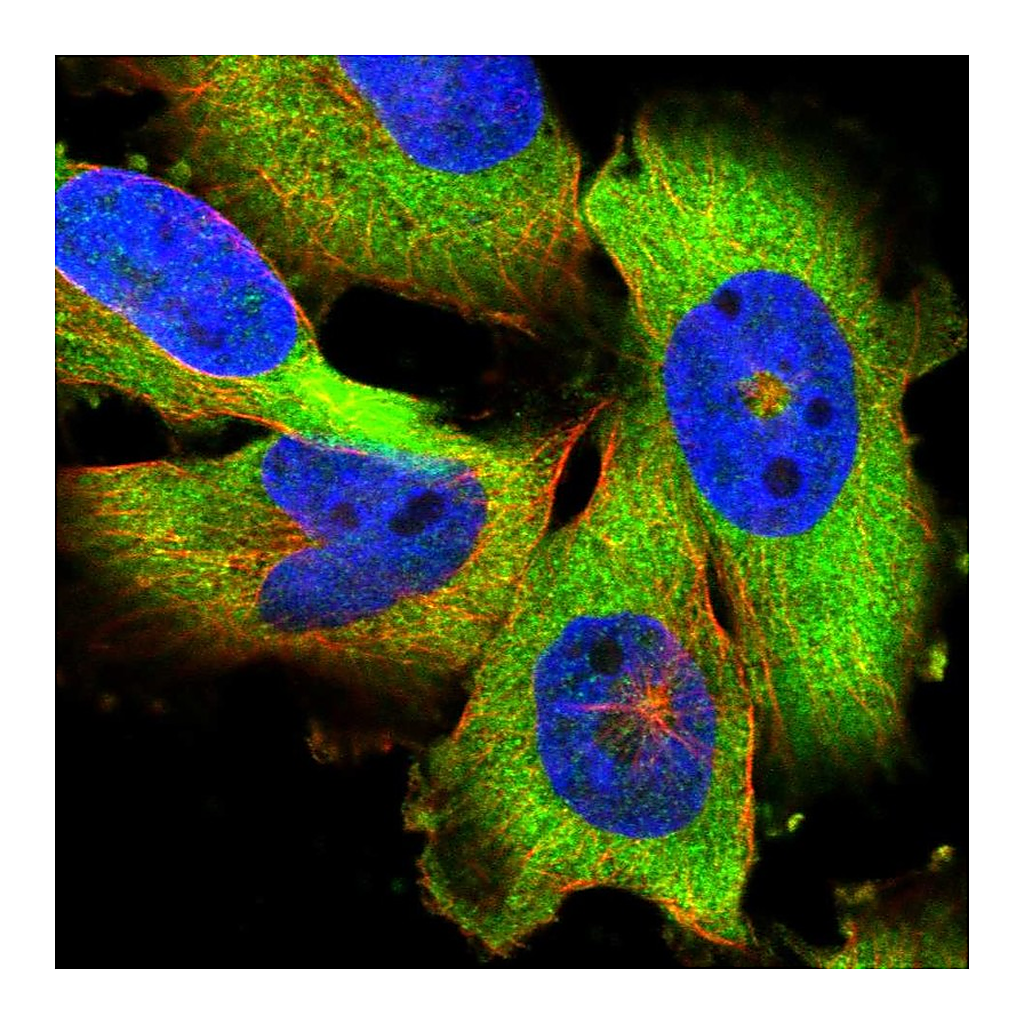 Atlas Antibodies Anti-PAPD4 Antibody