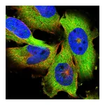 Atlas Antibodies Anti-PAPD4 Antibody