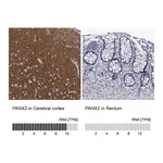 Atlas Antibodies Anti-PANX2 Antibody