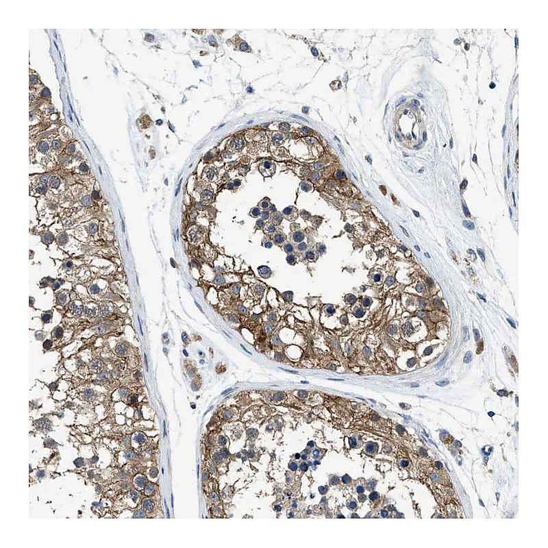 Atlas Antibodies Anti-PANX1 Antibody