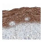 Atlas Antibodies Anti-PAPD5 Antibody