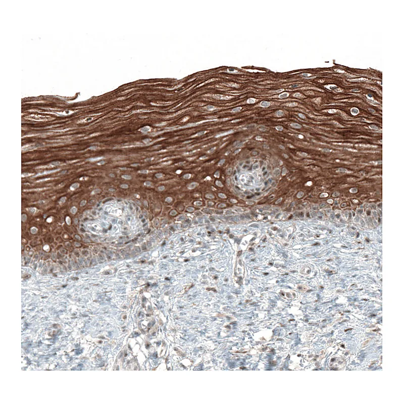 Atlas Antibodies Anti-PAPD5 Antibody