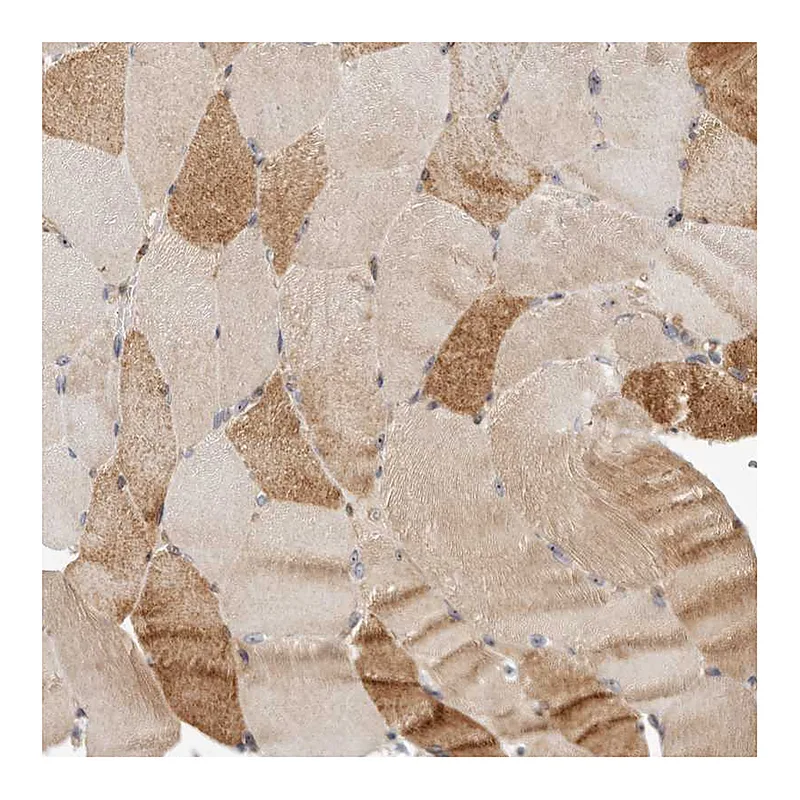 Atlas Antibodies Anti-PANK4 Antibody