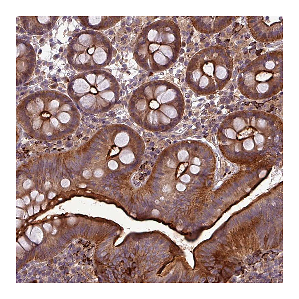 Atlas Antibodies Anti-PAPLN Antibody