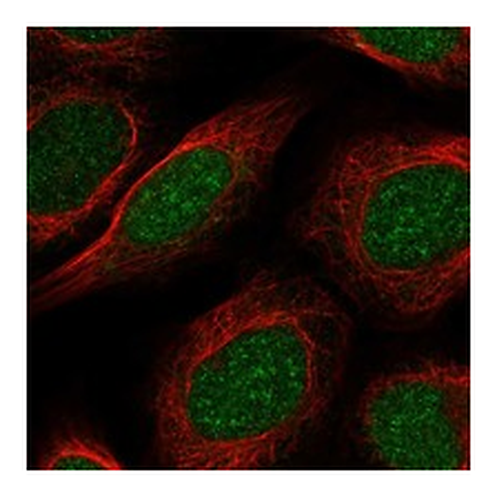 Atlas Antibodies Anti-PAPOLB Antibody