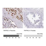 Atlas Antibodies Anti-PAPPA2 Antibody