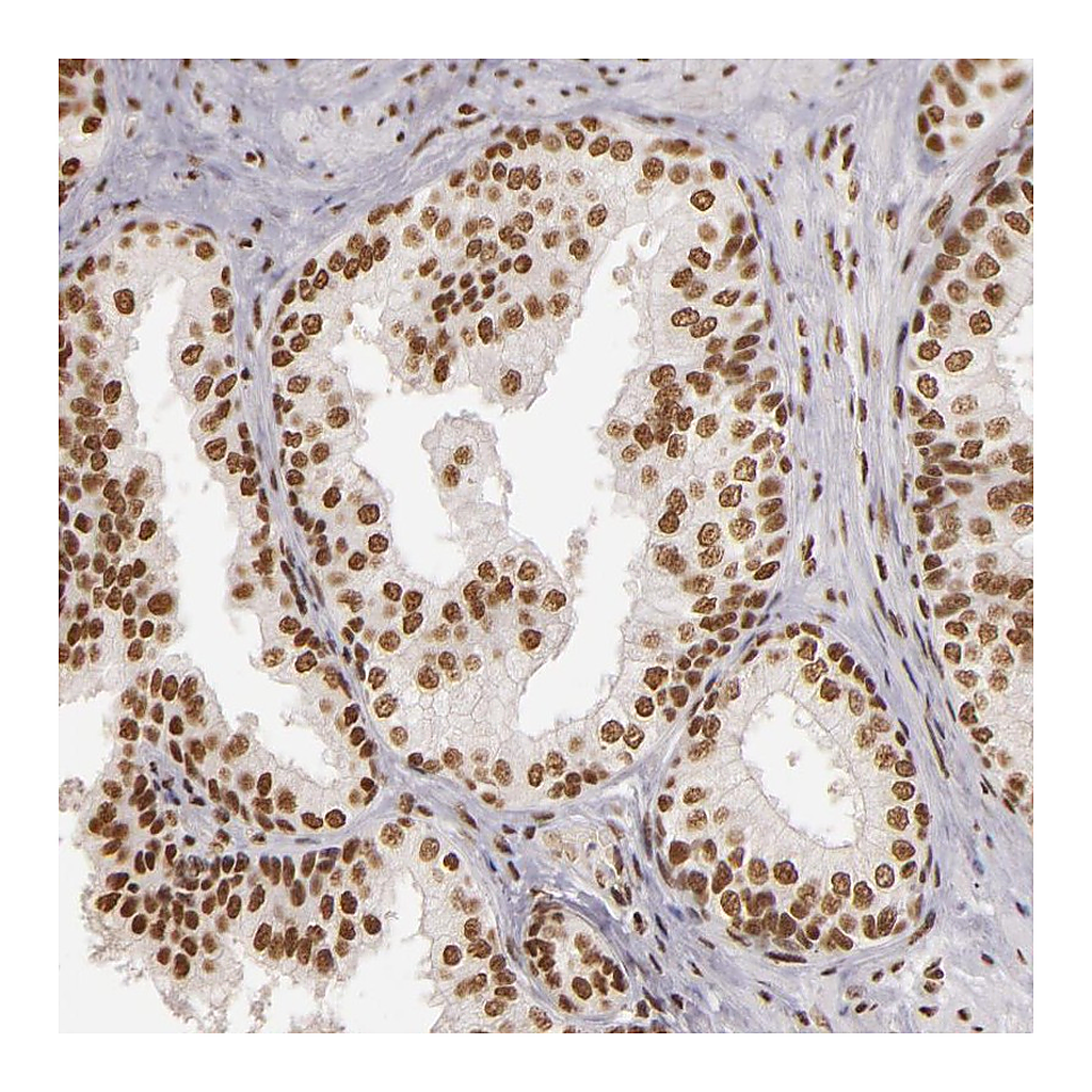 Atlas Antibodies Anti-PAPOLA Antibody