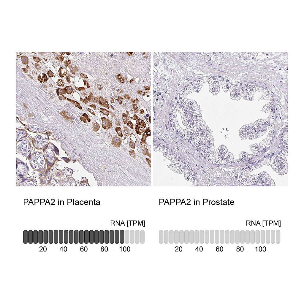 Atlas Antibodies Anti-PAPPA2 Antibody