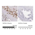 Atlas Antibodies Anti-PAPPA2 Antibody