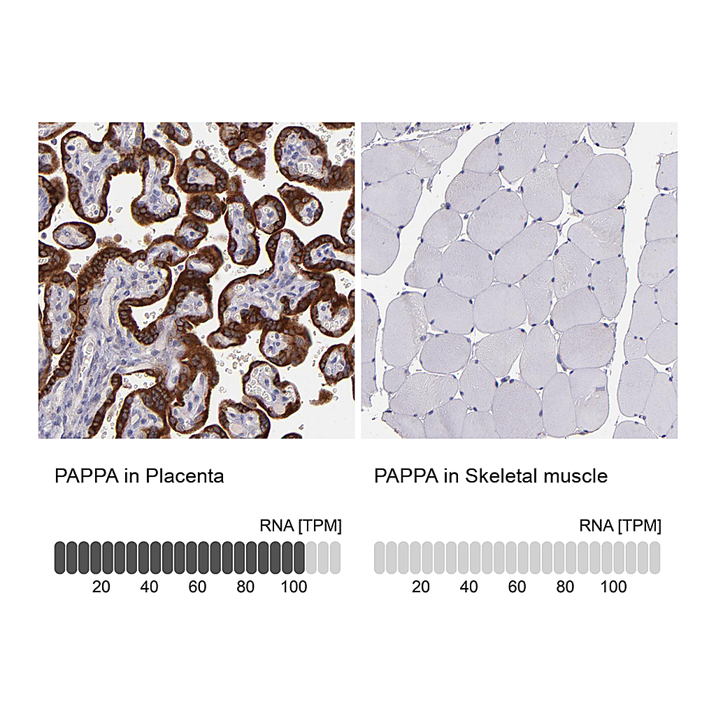 Atlas Antibodies Anti-PAPPA Antibody