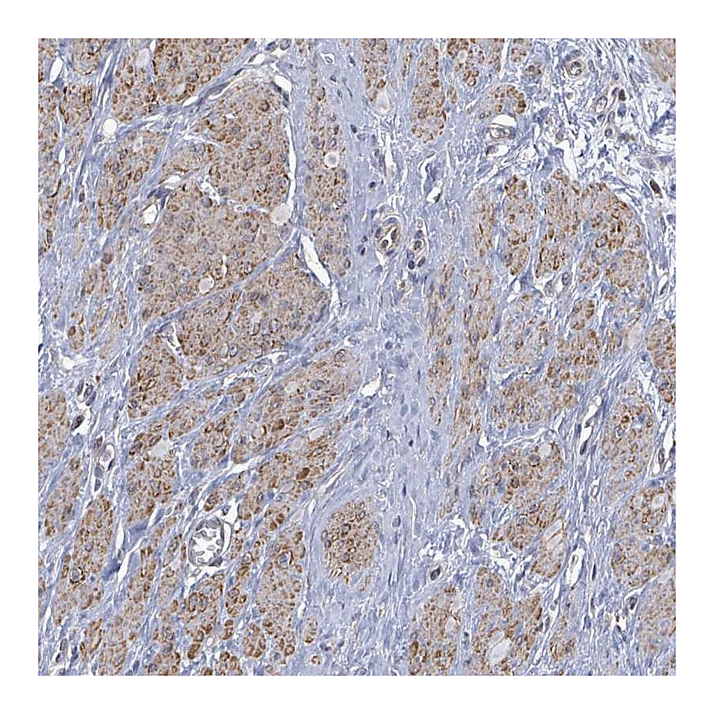 Atlas Antibodies Anti-PAPSS1 Antibody