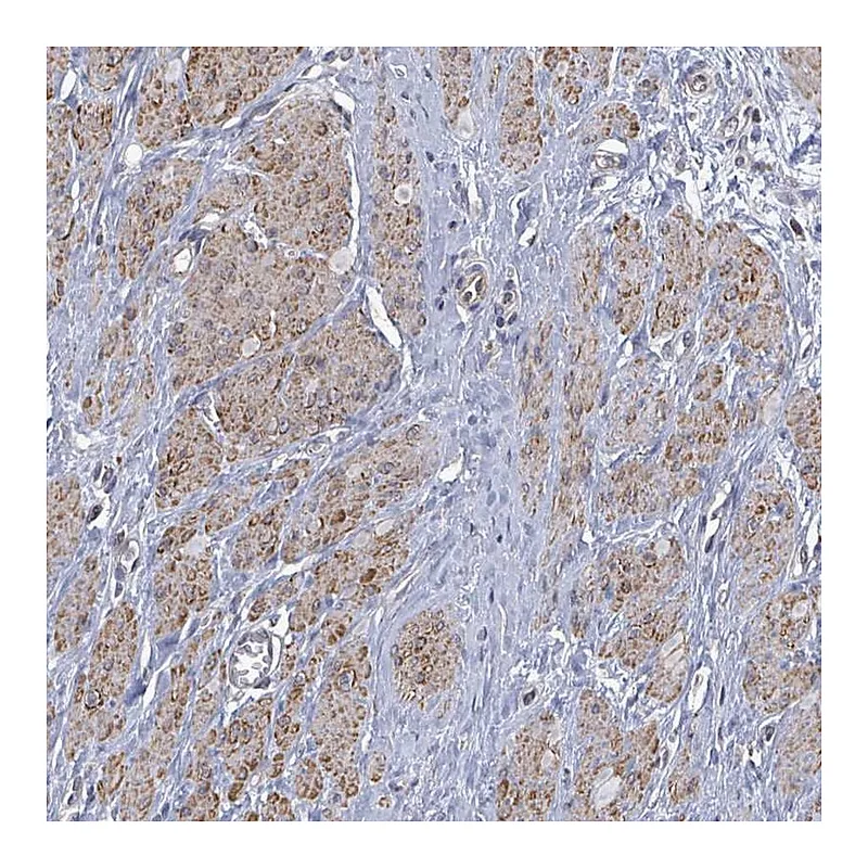 Atlas Antibodies Anti-PAPSS1 Antibody